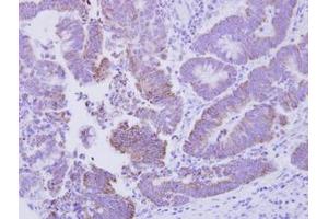 Image no. 1 for anti-CG1458 (CG1458) (AA 1-133) antibody (ABIN1496301) (CG1458 抗体  (AA 1-133))
