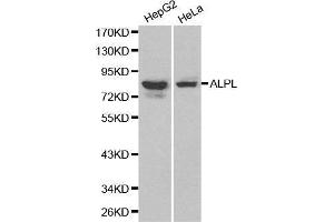 Western blot analysis of HepG2 cell and Hela cell lysate using ALPL antibody. (ALPL 抗体  (AA 20-270))