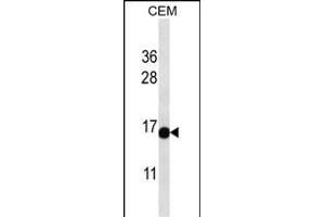 ATAD4 Antibody (C-term) (ABIN657177 and ABIN2837907) western blot analysis in CEM cell line lysates (35 μg/lane). (PRR15L 抗体  (C-Term))