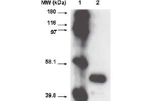 Western blot using CYP2A6 antibody  on recombinant cytochrome p450 at 1 µg/ml. (CYP2A6 抗体  (C-Term))