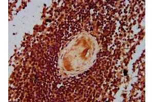 IHC image of ABIN7165194 diluted at 1:300 and staining in paraffin-embedded human spleen tissue performed on a Leica BondTM system. (CBFA2T3 抗体  (AA 39-159))