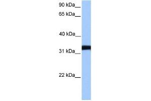 LDHC antibody used at 1 ug/ml to detect target protein.