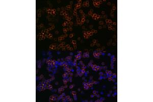 Immunofluorescence analysis of THP-1 cells using CD13/ANPEP Rabbit mAb (ABIN7265525) at dilution of 1:100 (40x lens). (CD13 抗体)