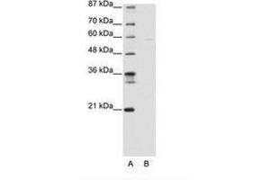 Image no. 1 for anti-SWI/SNF Related, Matrix Associated, Actin Dependent Regulator of Chromatin, Subfamily D, Member 3 (SMARCD3) (AA 139-188) antibody (ABIN6736140) (SMARCD3 抗体  (AA 139-188))