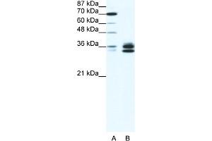 WB Suggested Anti-RELA Antibody Titration:  1. (NF-kB p65 抗体  (N-Term))
