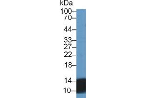 Western Blot; Sample: Human Urine; Primary Ab: 2µg/ml Rabbit Anti-Human UCN2 Antibody Second Ab: 0. (Urocortin 2 抗体  (AA 20-112))