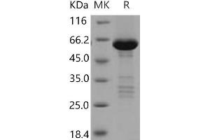 TRIB2 Protein (GST tag,His tag)