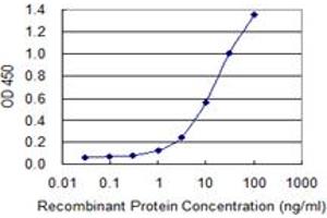Detection limit for recombinant GST tagged ROCK2 is 0. (ROCK2 抗体  (AA 1279-1388))