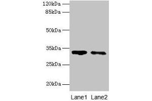 Western blot All lanes: SLA antibody at 5 μg/mL Lane 1: 293T whole cell lysate Lane 2: A431 whole cell lysate Secondary Goat polyclonal to rabbit IgG at 1/10000 dilution Predicted band size: 32, 20, 34, 28, 36 kDa Observed band size: 32 kDa (SLA 抗体  (AA 2-276))