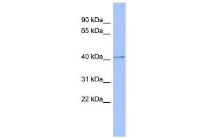 Western Blotting (WB) image for anti-Protein Kinase, CAMP-Dependent, Regulatory, Type I, beta (PRKAR1B) (Middle Region) antibody (ABIN2786692)