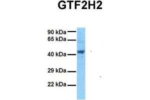 Host:  Rabbit  Target Name:  GTF2H2  Sample Tissue:  Human 293T  Antibody Dilution:  1. (GTF2H2 抗体  (C-Term))