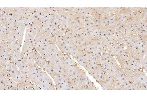 Detection of MMP2 in Human Cardiac Muscle Tissue using Polyclonal Antibody to Matrix Metalloproteinase 2 (MMP2) (MMP2 抗体  (AA 110-660))