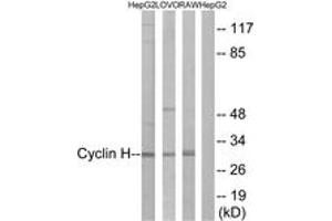 Western blot analysis of extracts from HepG2/LOVO/RAW264. (Cyclin H 抗体  (AA 274-323))
