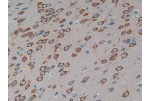 DAB staining on IHC-P; Samples: Rat Brain Tissue (Cx40/GJA5 抗体  (AA 50-303))