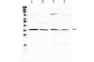 Western blot analysis of Annexin IV using anti- Annexin IV antibody . (Annexin IV 抗体  (Middle Region))