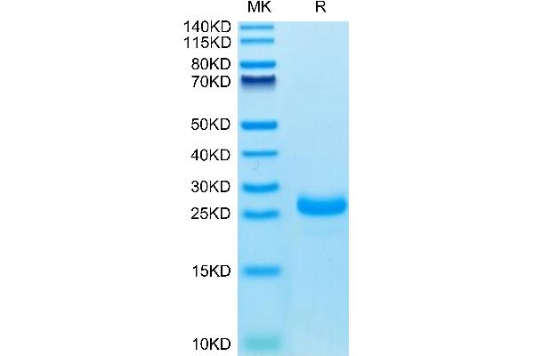 IL-33 Protein (AA 109-270) (His tag)