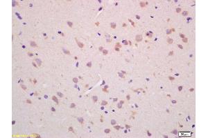 Formalin-fixed and paraffin embedded rat brain labeled with Rabbit Anti CHAC1 Polyclonal Antibody, Unconjugated (ABIN872557) at 1:200 followed by conjugation to the secondary antibody and DAB staining (CHAC1 抗体  (AA 131-222))