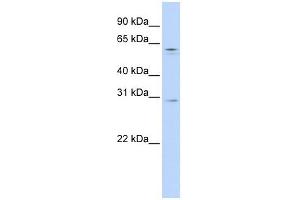 Rec8 antibody used at 1 ug/ml to detect target protein. (REC8 抗体)