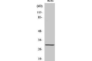 Western Blotting (WB) image for anti-Homeobox B5 (HOXB5) (Internal Region) antibody (ABIN3185074) (HOXB5 抗体  (Internal Region))