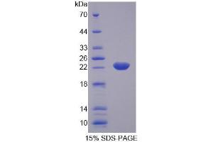 SDS-PAGE analysis of Rat KTN1 Protein. (KTN1 蛋白)