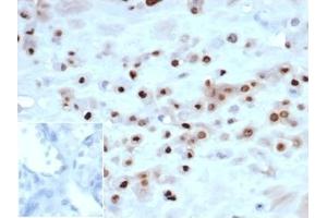 IHC analysis of formalin-fixed, paraffin-embedded human placenta. (Recombinant CDKN1C 抗体)