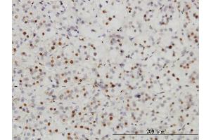 Immunostaining (ISt) image for anti-SUMO1 Activating Enzyme Subunit 1 (SAE1) (AA 1-346) antibody (ABIN564342)