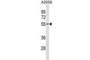 Western Blotting (WB) image for anti-Thioredoxin-Related Transmembrane Protein 3 (TMX3) antibody (ABIN3001033) (TMX3 抗体)