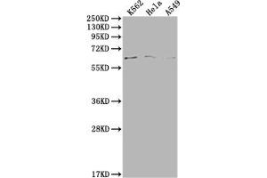 Western Blot Positive WB detected in: K562 whole cell lysate, Hela whole cell lysate, A549 whole cell lysate All lanes: MAP3K7 antibody at 1:500 Secondary Goat polyclonal to rabbit IgG at 1/50000 dilution Predicted band size: 68, 65, 57, 54 kDa Observed band size: 68 kDa (MAP3K7 抗体  (AA 179-194))