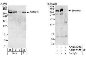Western blot analysis of SPTBN2 in HeLa whole cell lysate (5, 15 and 50 ug for WB; 1 mg for IP, 20% of IP loaded) and HEK 293T (Bosc 23) (T : 50 ug) cells with SPTBN2 polyclonal antibody . (Spectrin, Beta, Non-erythrocytic 2 (SPTBN2) (C-Term) 抗体)