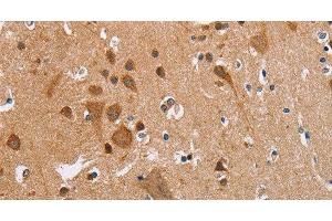 Immunohistochemistry of paraffin-embedded Human brain using CK-13 Polyclonal Antibody at dilution of 1:35 (Cytokeratin 13 抗体)