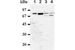 Western Blotting (WB) image for anti-RAD17 (RAD17) antibody (ABIN492574) (RAD17 抗体)