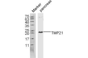 Lane 1: Mouse pancreas lysates probed with TMP21 Polyclonal Antibody, Unconjugated  at 1:300 overnight at 4˚C. (TMED10 抗体  (AA 101-200))