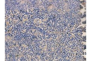 ABIN6260744 and ABIN6272626 at 1/100 staining human normal tonsil tissue by IHC-P. (CEACAM8 抗体  (N-Term))