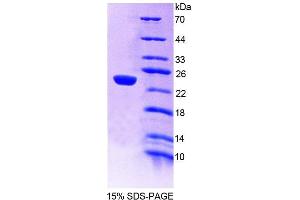 SDS-PAGE analysis of Mouse GaA Protein. (GAA 蛋白)