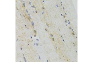 Immunohistochemistry of paraffin-embedded mouse skeletal muscle using GEMIN2 Antibody. (SIP1 抗体)