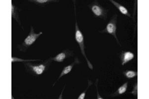 Immunofluorescent staining of HeLa (ATCC CCL-2) cells. (CDKN1B 抗体)