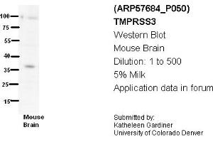 Image no. 3 for anti-Transmembrane Protease, Serine 3 (TMPRSS3) (N-Term) antibody (ABIN2787338) (TMPRSS3 抗体  (N-Term))