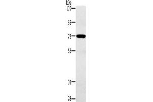 Gel: 6 % SDS-PAGE, Lysate: 40 μg, Lane: Mouse heart tissue, Primary antibody: ABIN7191964(POU6F2 Antibody) at dilution 1/200, Secondary antibody: Goat anti rabbit IgG at 1/8000 dilution, Exposure time: 30 seconds (POU6F2 抗体)