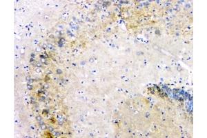 Flow cytometry testing of human PC-3 cells with Amyloid beta antibody at 1ug/10^6 cells (blocked with goat sera)