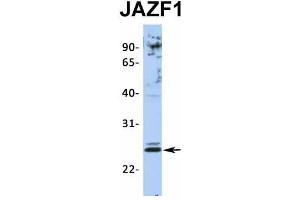 Host:  Rabbit  Target Name:  JAZF1  Sample Type:  Jurkat  Antibody Dilution:  1. (JAZF1 抗体  (N-Term))