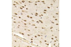 Immunohistochemistry of paraffin-embedded mouse brain using CBX8 antibody at dilution of 1:200 (400x lens).
