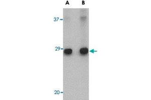 Western blot analysis of ELOVL6 in human brain tissue lysate with ELOVL6 polyclonal antibody  at (A) 1 and (B) 2 ug/mL . (ELOVL6 抗体  (C-Term))