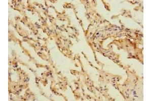 Immunohistochemistry of paraffin-embedded human lung tissue using ABIN7158886 at dilution of 1:100 (MARCO 抗体  (AA 421-520))