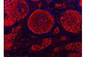 IF analysis of Cytokeratin 2e/KRT2 using anti-Cytokeratin 2e/KRT2 antibody (ABIN7600644). (Keratin 2 抗体  (AA 213-332))
