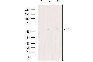 Western blot analysis of extracts from various samples, using CDKL2 Antibody. (CDKL2 抗体  (Internal Region))
