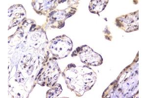 IHC analysis of EWSR1 using anti-EWSR1 antibody (ABIN6719313).