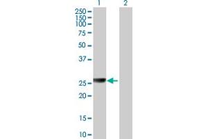 Western Blot analysis of ARG1 expression in transfected 293T cell line by ARG1 MaxPab polyclonal antibody. (Liver Arginase 抗体  (AA 1-236))