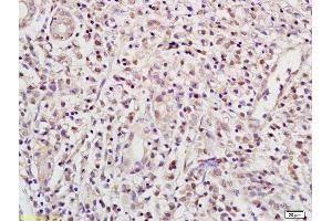 Immunohistochemistry (IHC) image for anti-Recombination Signal Binding Protein For Immunoglobulin kappa J Region (RBPJ) (AA 101-200) antibody (ABIN872972)