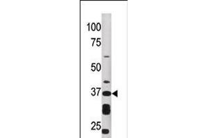 Western blot analysis of anti-ART1 Pab in HepG2 cell line lysate (35ug/lane) (ART1 抗体  (AA 210-240))