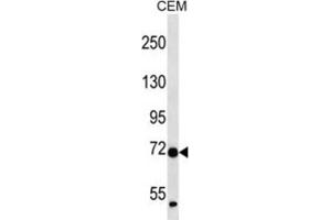 Western Blotting (WB) image for anti-Zinc Finger Protein 443 (ZNF443) antibody (ABIN2997281) (ZNF443 抗体)